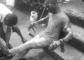 Survivor with burn injuries sitting on steps following Mira Oxygen blast in Liberia