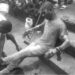 Survivor with burn injuries sitting on steps following Mira Oxygen blast in Liberia