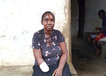 A woman with a bandaged arm sits outside her home in Todee District after a factory accident left her disabled.
