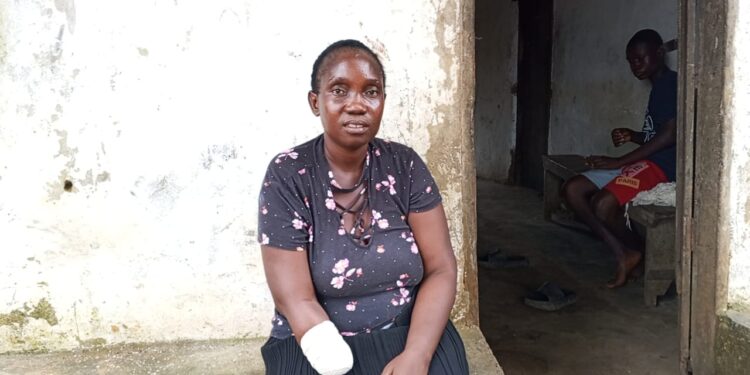 A woman with a bandaged arm sits outside her home in Todee District after a factory accident left her disabled.