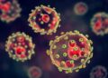 lassa fever