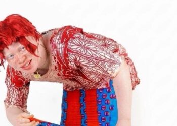 Advocates for persons with albinism in Liberia condemn AI-generated images spreading online discrimination and mockery.