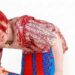 Advocates for persons with albinism in Liberia condemn AI-generated images spreading online discrimination and mockery.